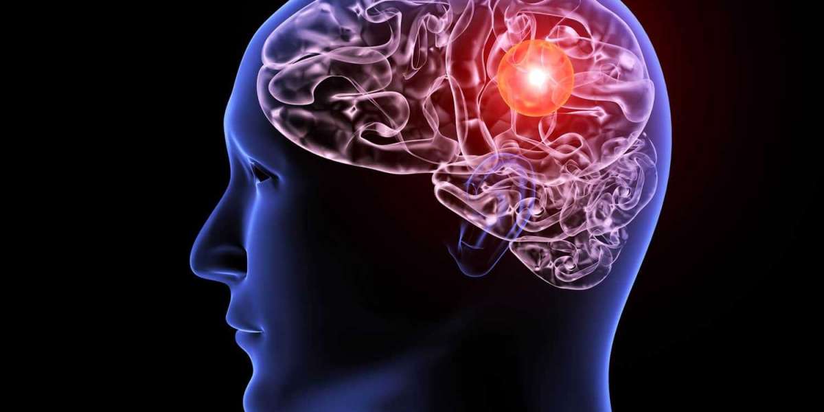 Improve Brain Power in Natural Way?