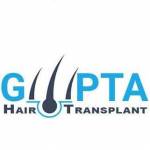Gupta Hair Transplant in Ludhiana Profile Picture