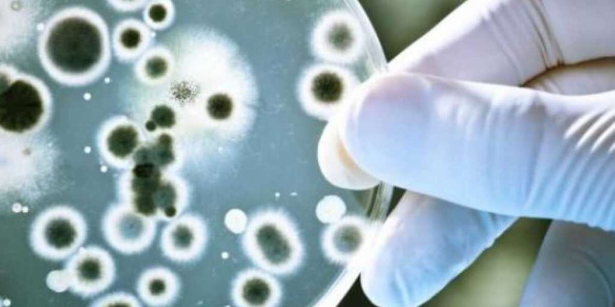 Antimicrobial Coatings for Medical Devices Market Analysis, Challenges, Growth and Forecast By 2030
