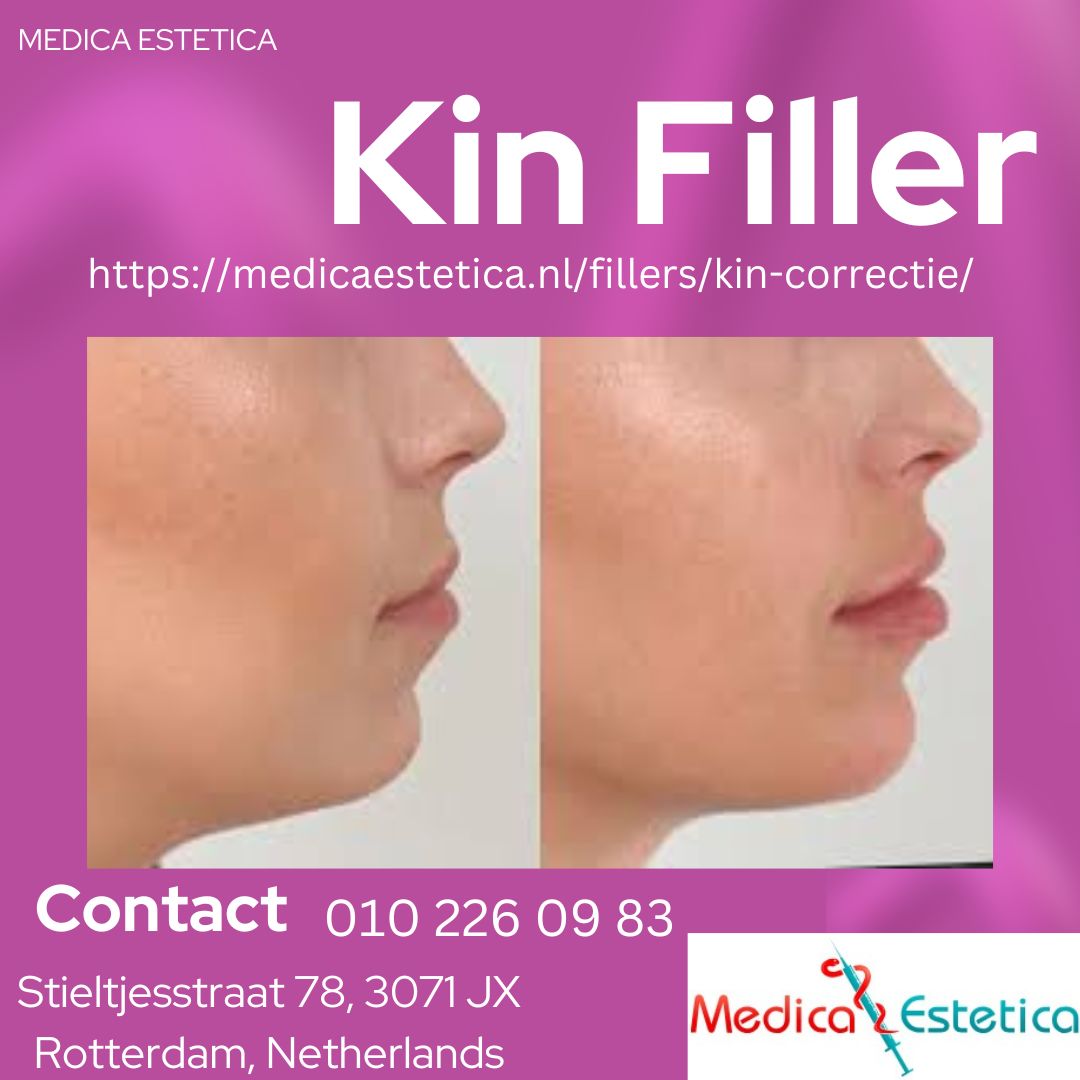 Kin filler- get a revitalized appearance comfortably without surgery - PenCraftedNews